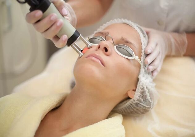 Face rejuvenation of the face