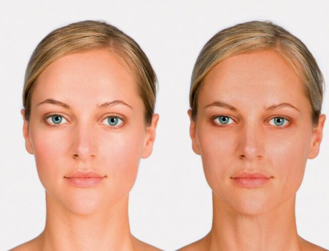 face later and before rejuvenation
