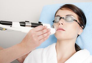 How laser rejuvenation is performed